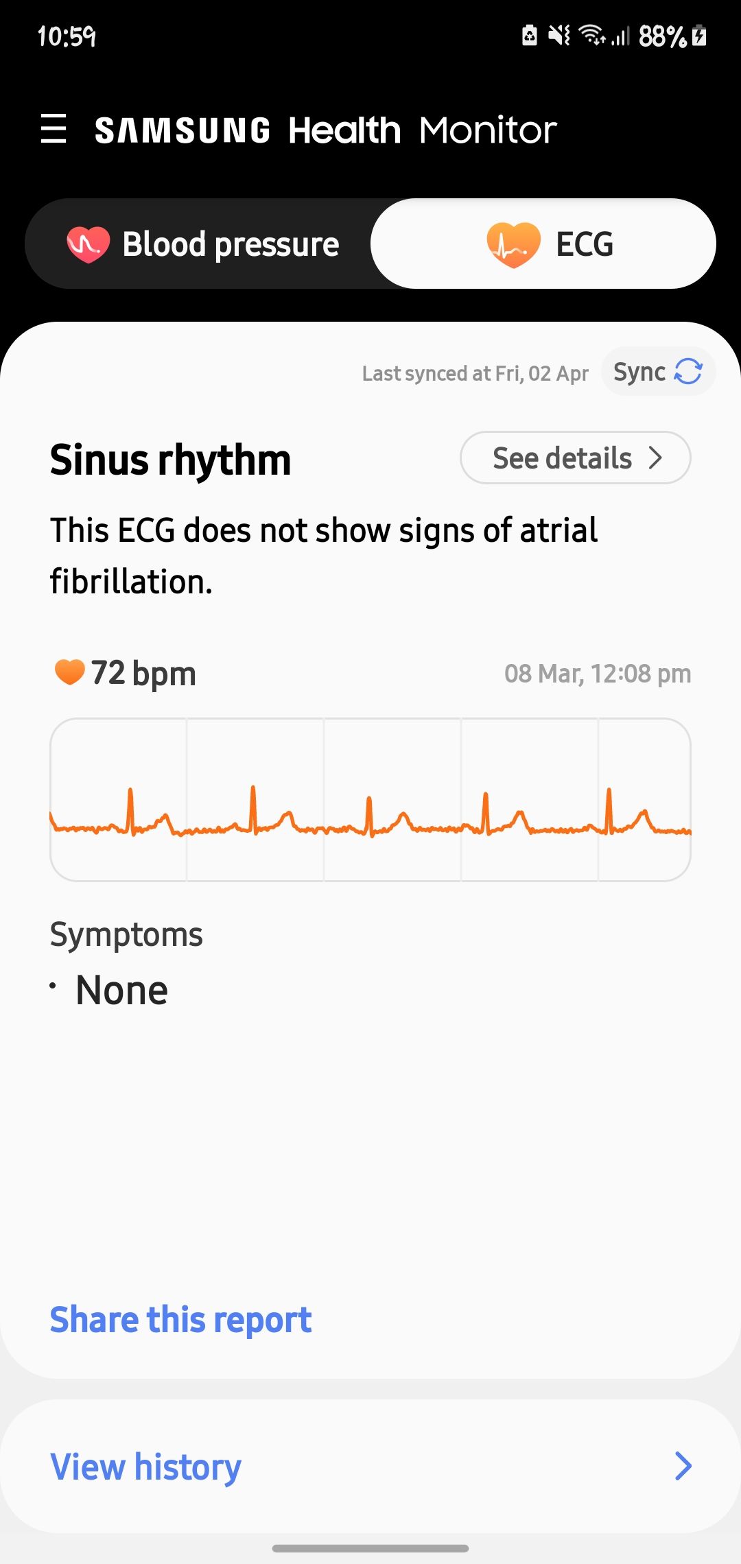 ECG/Blood Pressure GALAXY WATCH 3 Samsung Members